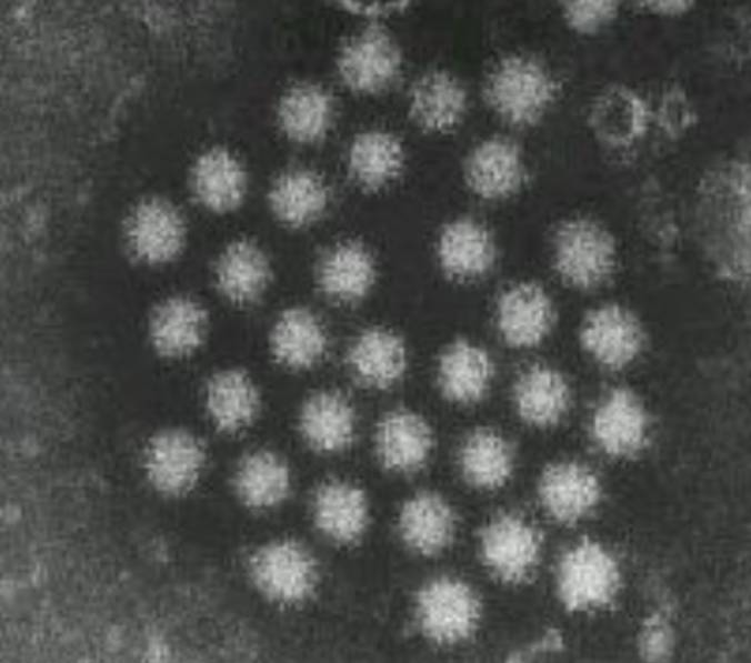 ノロウィルス菌の画像です。