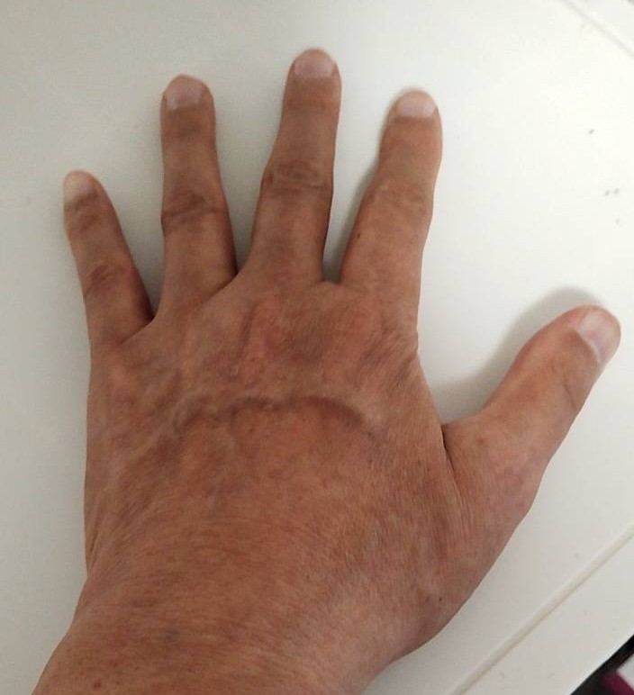 60歳視覚障害者男性の手の画像
